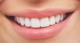 Whiter Teeth
